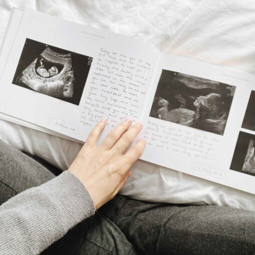 Timeless Treasures Capture Your Baby's Precious Moments in a Luxurious Memory Book - Image 5